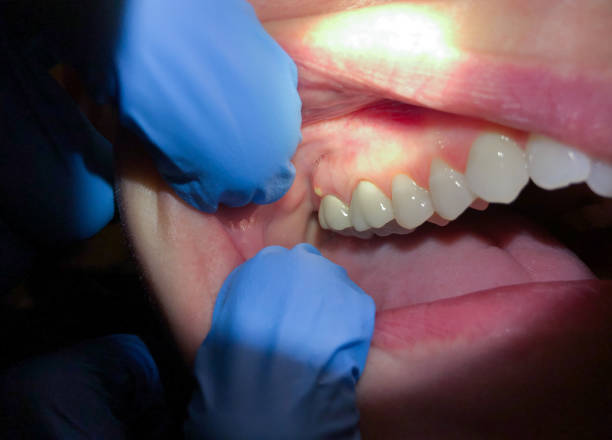 Best Orthodontic Emergency Dentist in Hoback, WY